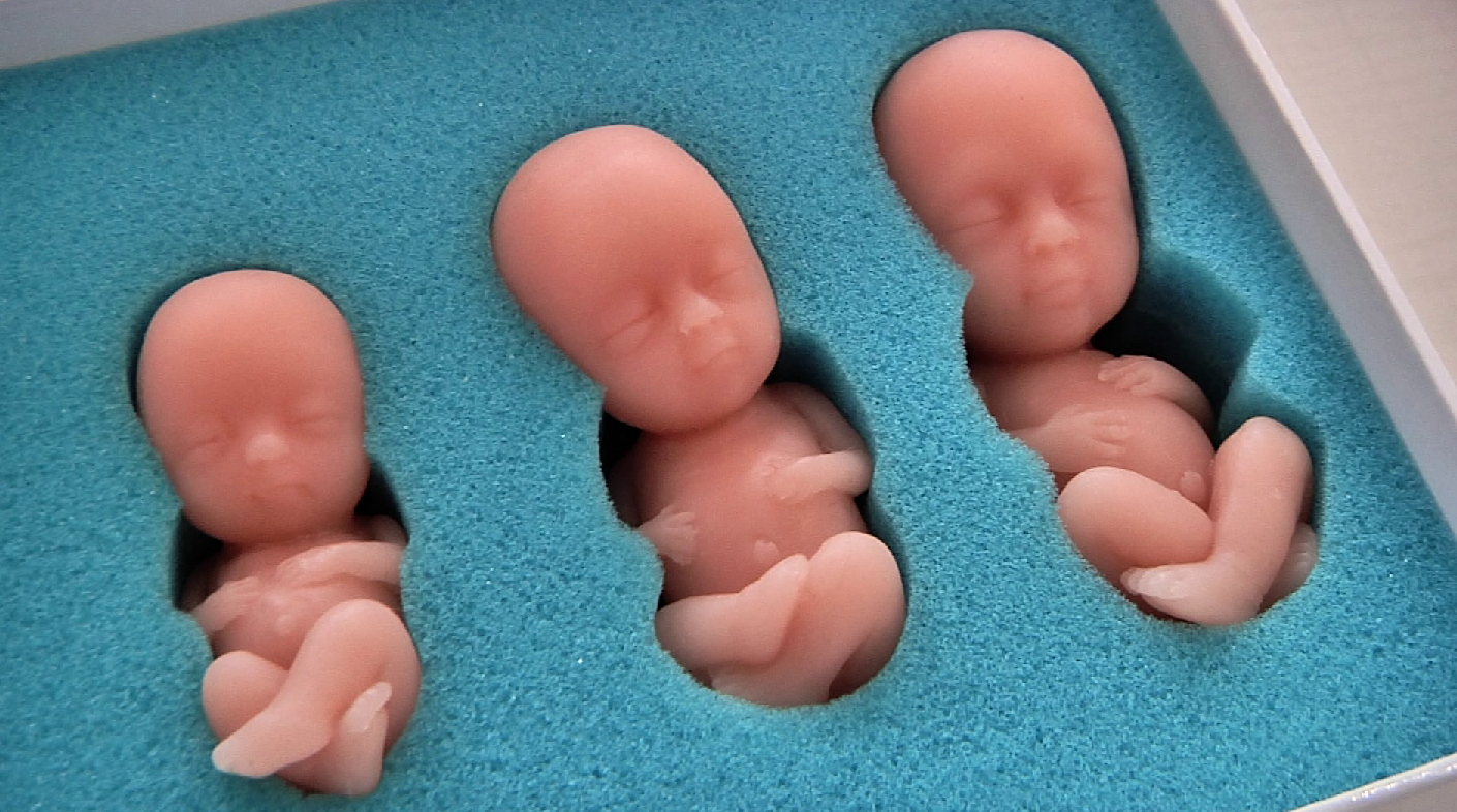Для наглядности: в Новокузнецке для лекций будущим мамам закупили набор моделей эмбрионов