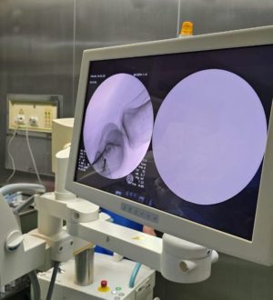 Кузбасские врачи впервые провели сложную диагностическую процедуру