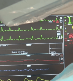 Новокузнецкие хирурги научились проводить редкие операции на сердце