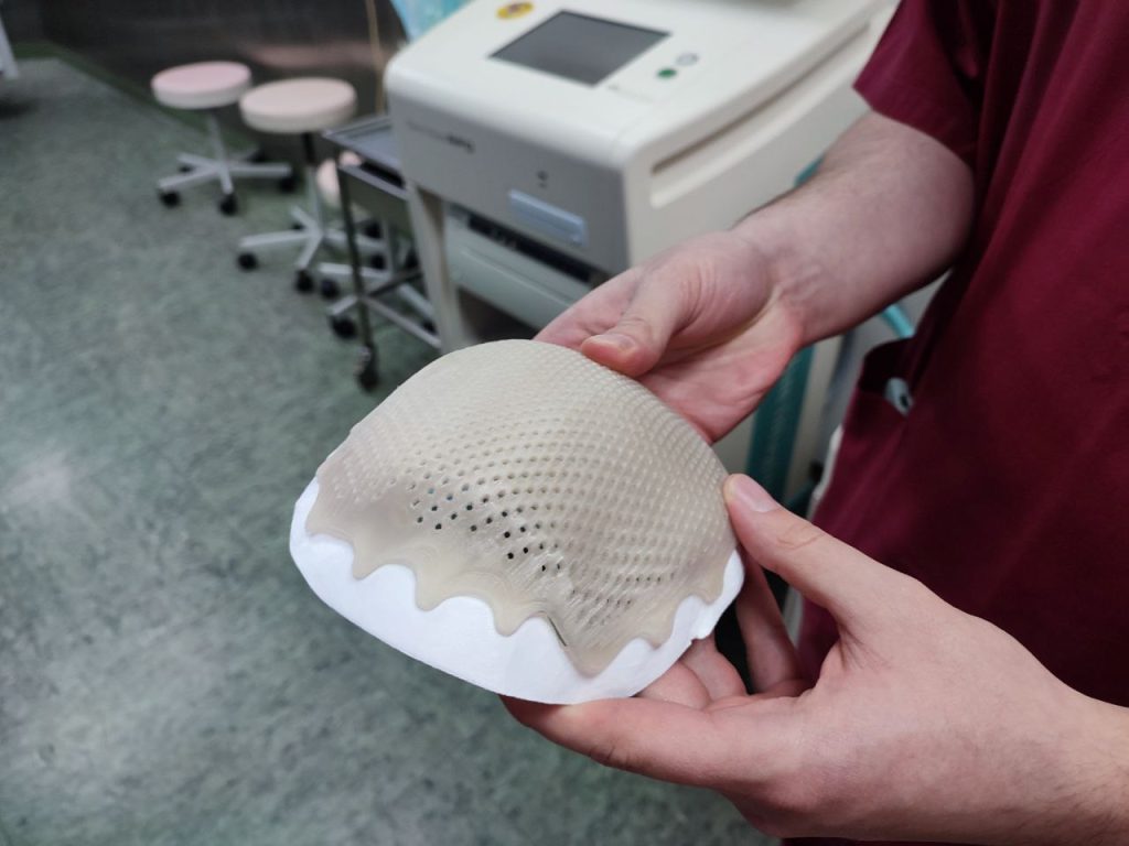 Кузбасские врачи после тяжелого ранения восстановили череп участнику СВО