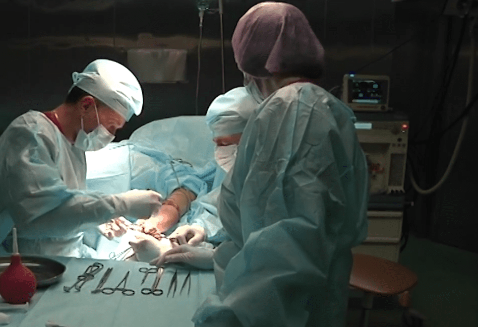 В Кузбассе врачи разделили сросшиеся после ожогов пальцы пациенту из Тывы