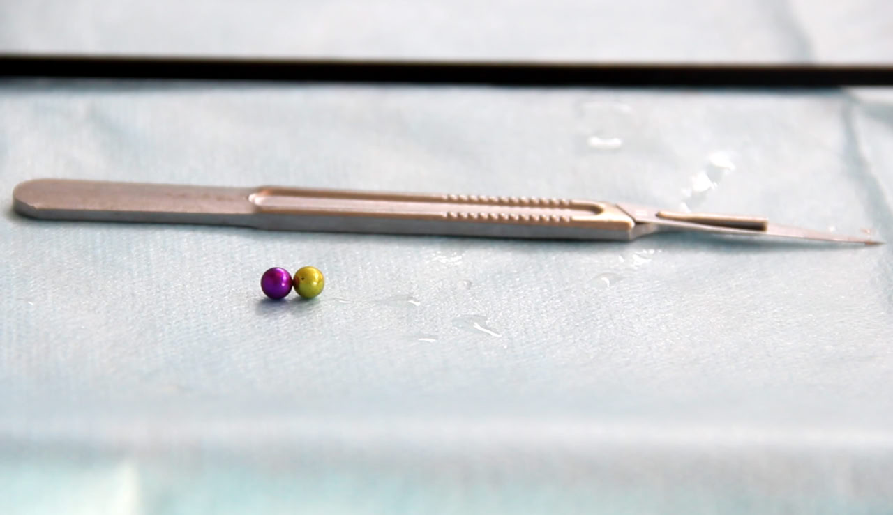 В Кузбассе годовалый ребенок проглотил больше двух десятков магнитных шариков