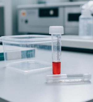 Минздрав: тест на ВИЧ стал для россиян привычной процедурой