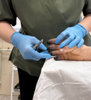 Первые случаи обморожения фиксируют в Новокузнецке