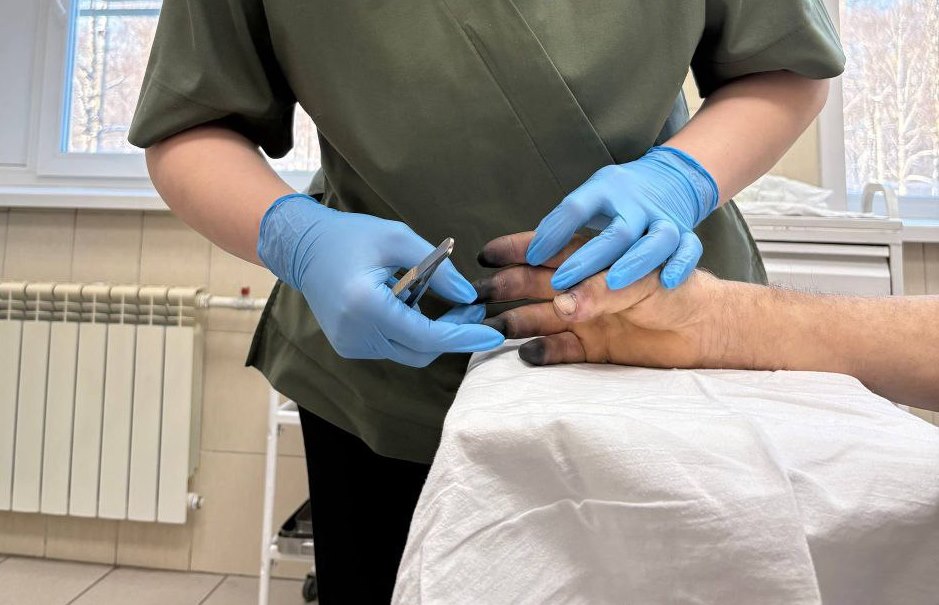 Первые случаи обморожения фиксируют в Новокузнецке